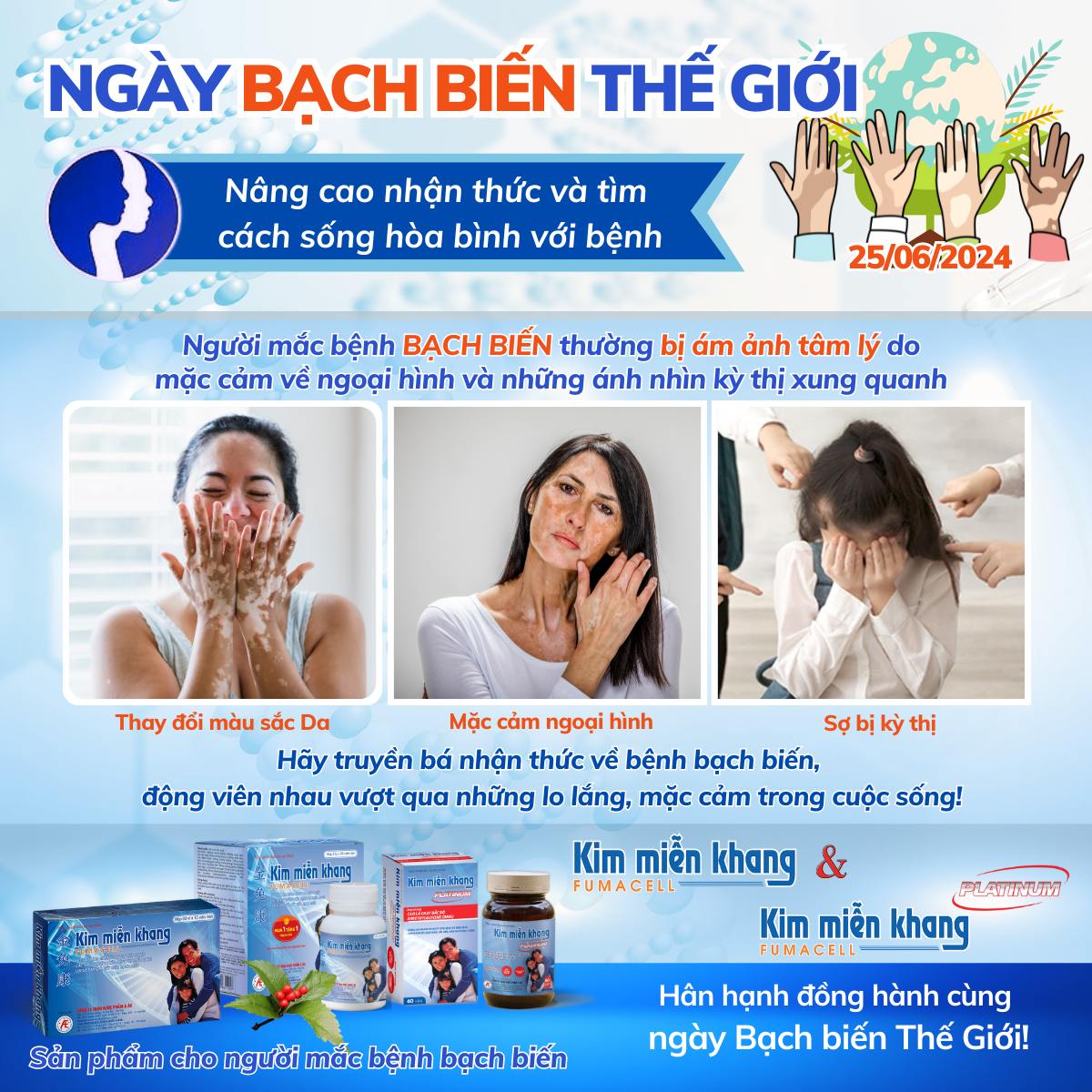 Ngày Bạch biến thế giới là dịp để mọi người nâng cao nhận thức về bệnh